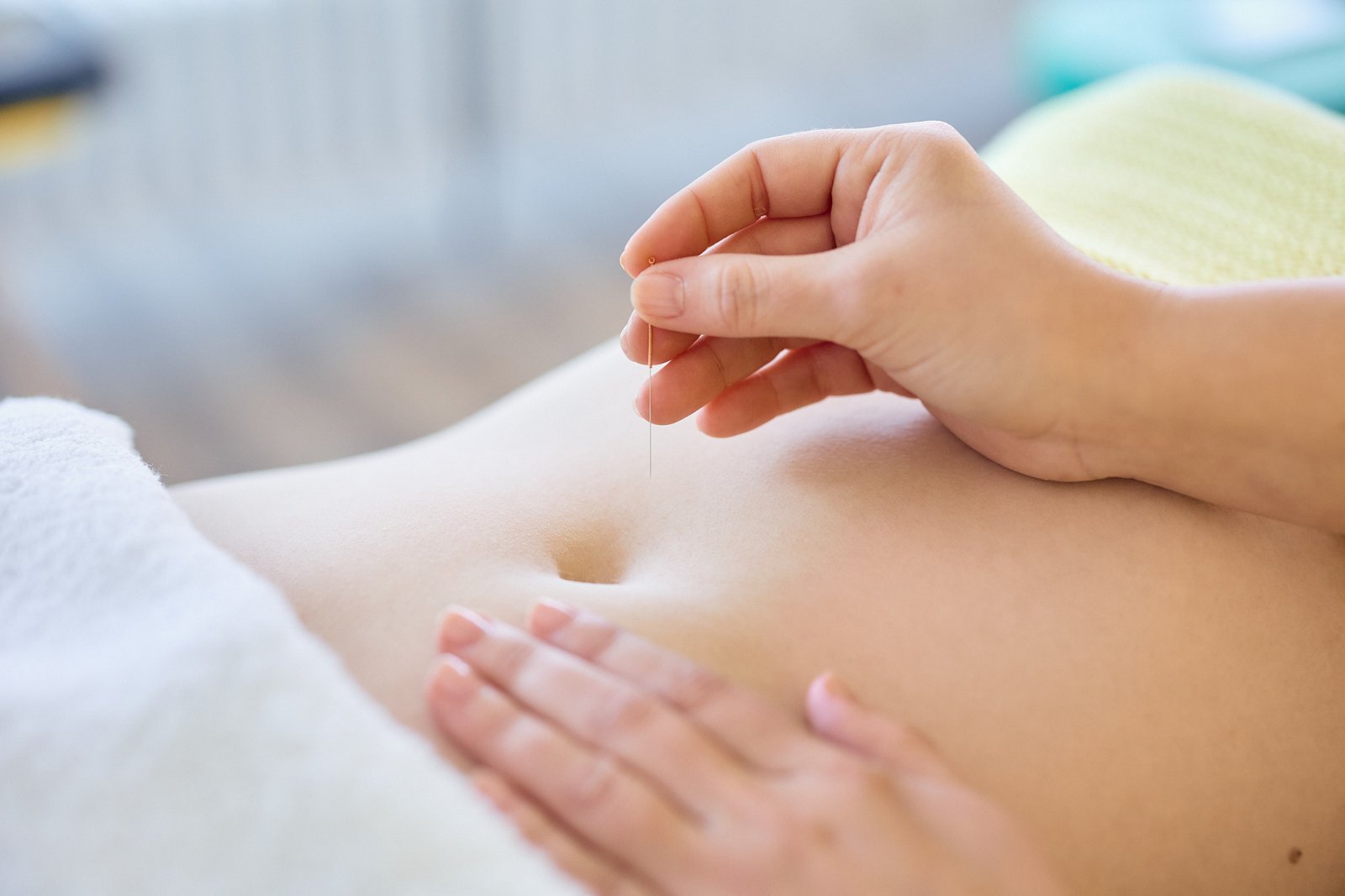 Akupunktur